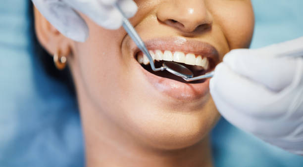 Best Emergency Dental Care for Broken or Chipped Teeth in Chaska, MN